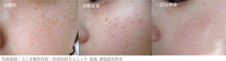 トリニティプラス