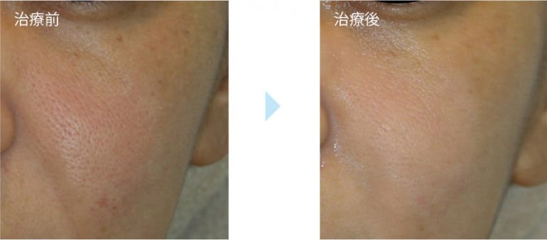 トリニティプラス