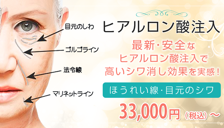 ヒアルロン酸注入